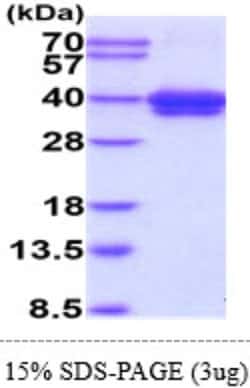 Novus Biologicals&trade;&nbsp;Recombinant Human CD52 Protein